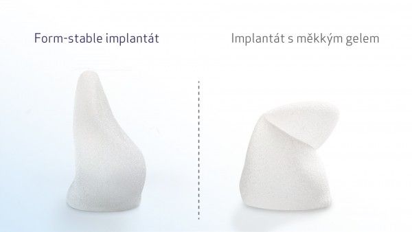 prsní implantaty