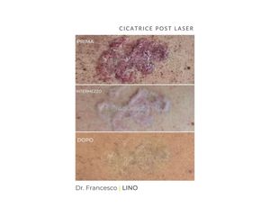 Cicatrici - Dott. Francesco Lino