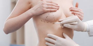 Co s kapsulací po augmentaci prsou?