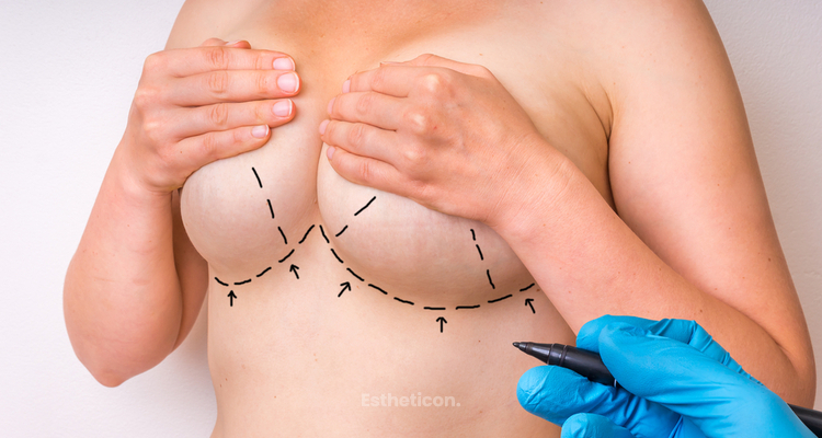 Co vás, nás, může potkat po augmentaci silikonovými implantáty