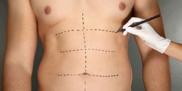 David zhubl 75 kg: „Abdominoplastika je pro mě druhá šance na normální život" David zhubl 75 kg: „Abdominoplastika je pro mě druhá šance na normální život"