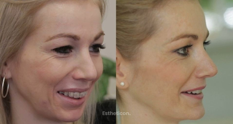 Jak stvořit krásný obličej se dá spočítat, říká chirurg z Perfect Clinic