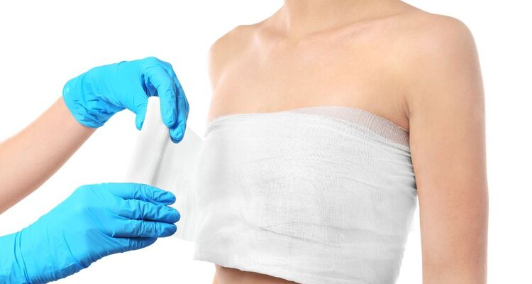 Zvětšení prsou: Jaký povrch prsních implantátů je pro vás vhodný