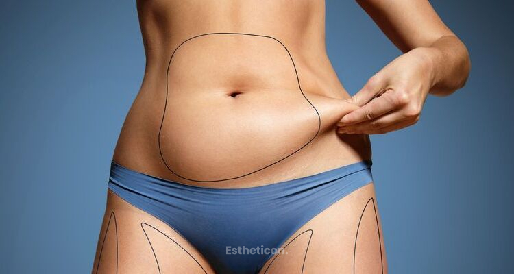 Liposukce, abdominoplastika nebo obojí?