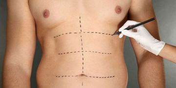 Liposukce může zkrášlit i muže