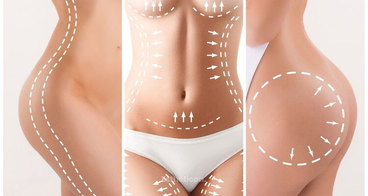 Lipotransfer aneb Tuk na těch správných místech