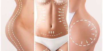 Lipotransfer aneb Tuk na těch správných místech Lipotransfer aneb Tuk na těch správných místech
