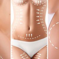 Lipotransfer aneb Tuk na těch správných místech