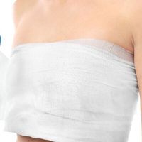 Mammaplastika: Krásná prsa