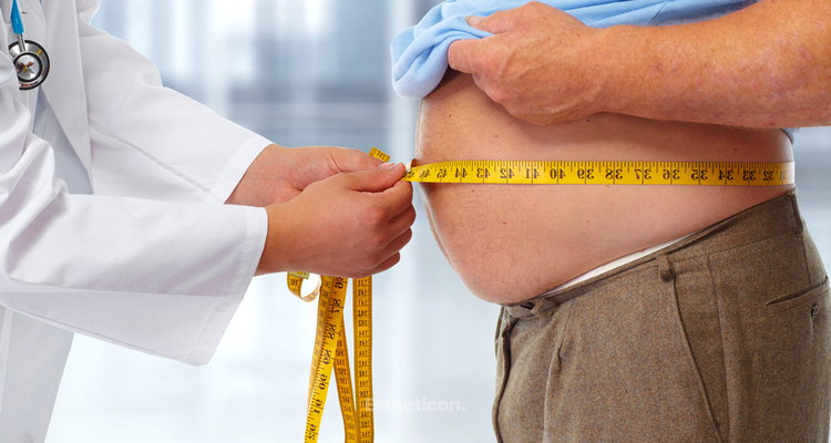 Operační léčba těžké obezity - bariatrická chirurgie