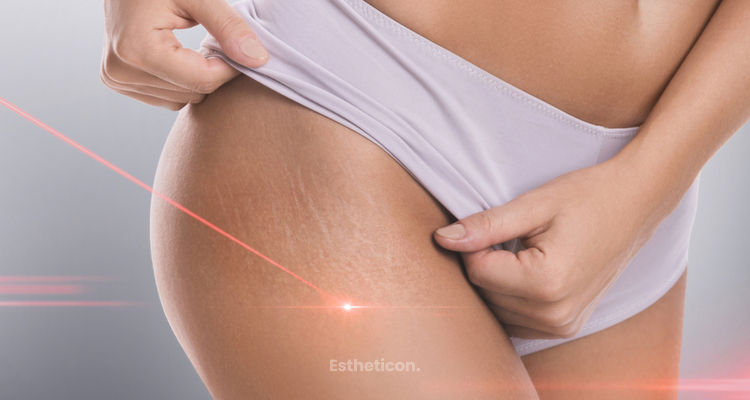 Využití laserů v dermatologii