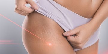 Využití laserů v dermatologii