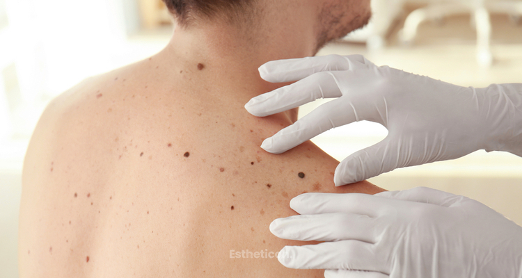Digitální dermatoskop vs. klasické vyšetření: jaké jsou výhody moderní technologie