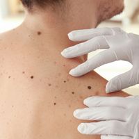 Digitální dermatoskop vs. klasické vyšetření: jaké jsou výhody moderní technologie
