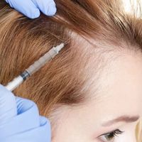 Lupénka ve vlasech: jak ji rozpoznat a léčit