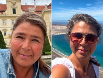 Gastrický bypass před a po - 878925