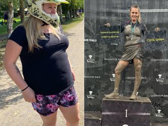 Gastrický bypass před a po - 878926