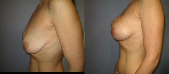 model5