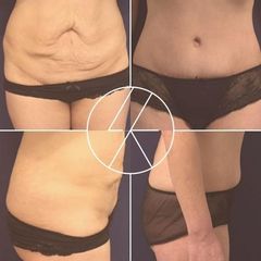 ab1