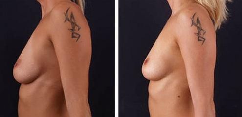 pred po1 500x427