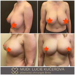redukce2