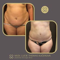 MUDr. Lucie Thomas Kučerová