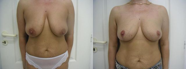 26xab26