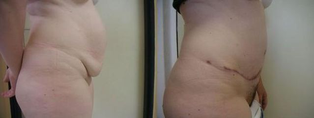 tn zoom obrazek 163(1) 220 x 293