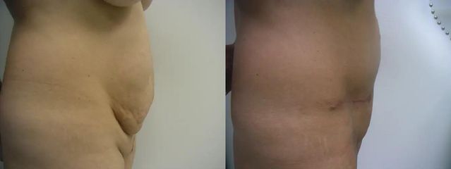 ab1