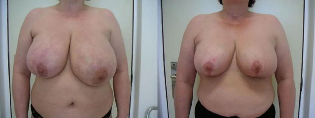 z18