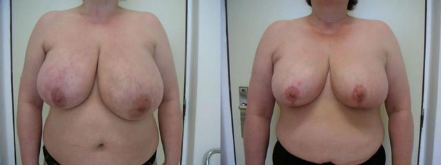 MODELACEA PRED