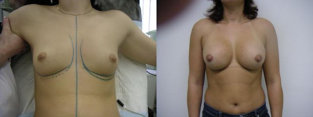 30xab30
