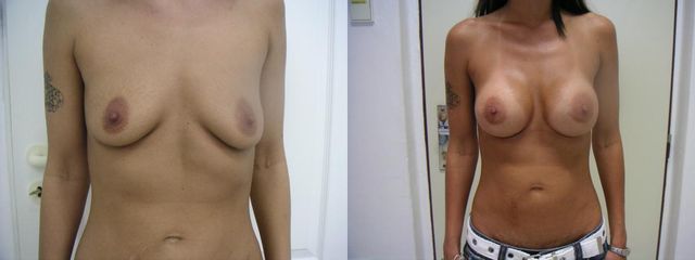 29xab29