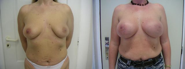 27xab27