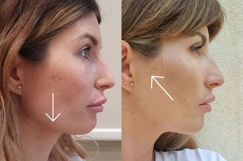 Antiaging před a po - 859339