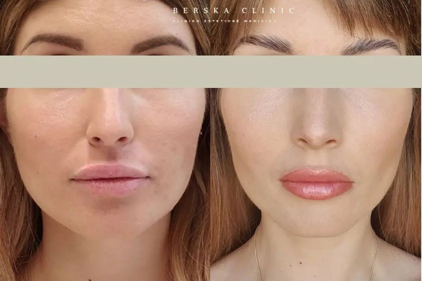 Antiaging před a po - 859341