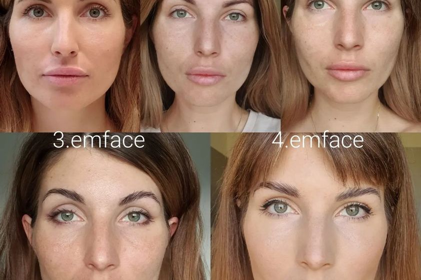 Antiaging před a po - 859344