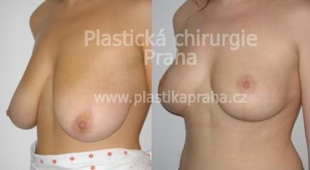 predapo (1)