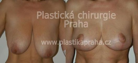 predapo (5)
