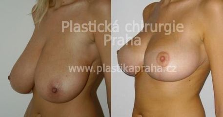 predapo (6)