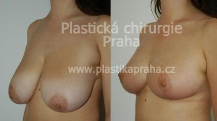 predapo (7)