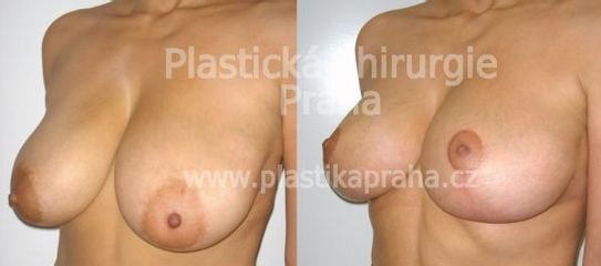 predapo (9)