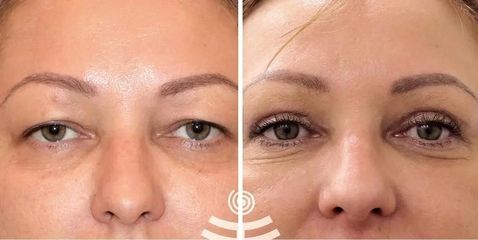 BEFORE zPZUSjxxC5s (1)