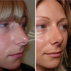 BEFORE QSlnAtc5ko0 (1)