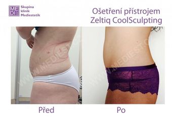FOTO01