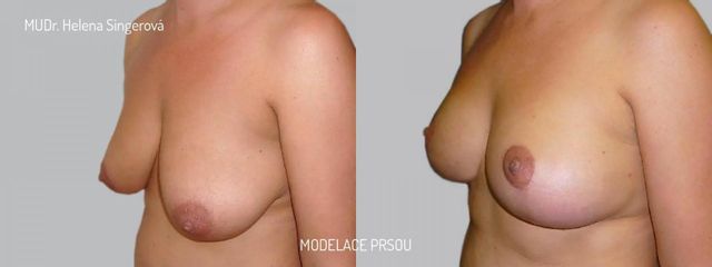 BEFORE modelace 1