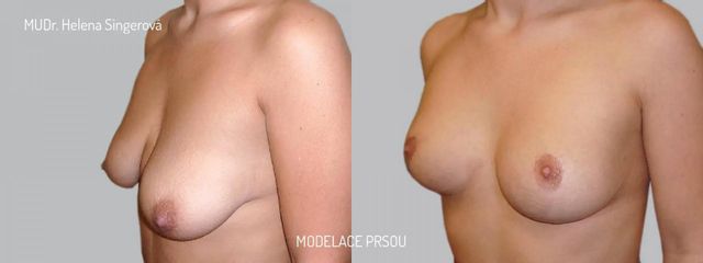 BEFORE modelace 3