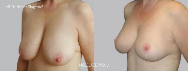 BEFORE modelace 4