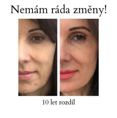 Kyselina hyaluronová - Dermaline Clinic