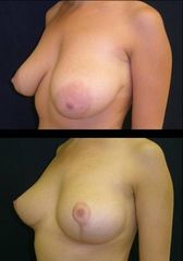 modelace prsu